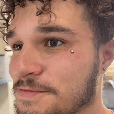 DERMAL PIERCING